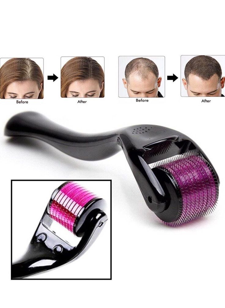 Derma Roller